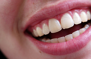 Bioniczne zęby - rewolucja w stomatologii