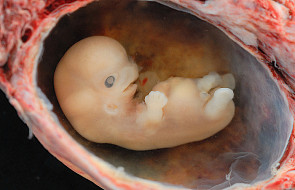 Doświadczenia z ludzkimi embrionami w USA