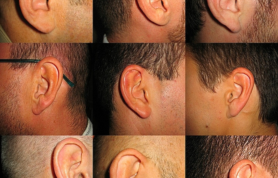 Что означают уши для мусульман. Необычные ушные раковины. Необычные формы ушной раковины.