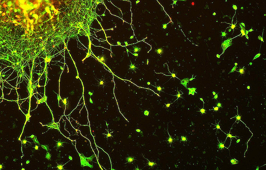 Neurony są zaskakująco samodzielne