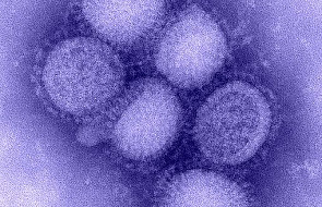 Polska: Dwie ofiary grypy A/H1N1