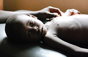 Głód w Afryce. Obudzić na nowo hojność ludzi!