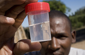 Malaria śmiertelnie groźna dla podróżników