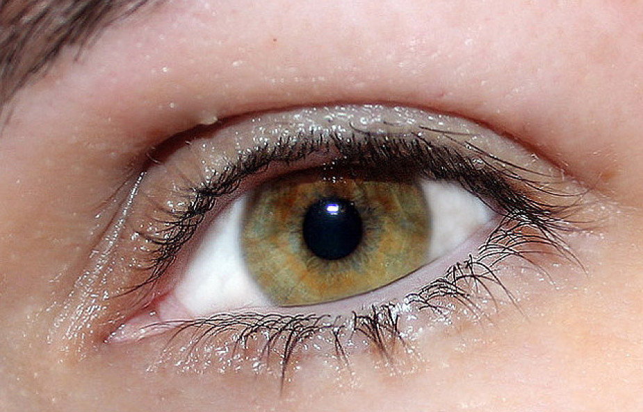 Kolor oczu ma związek z chorobami skóry?