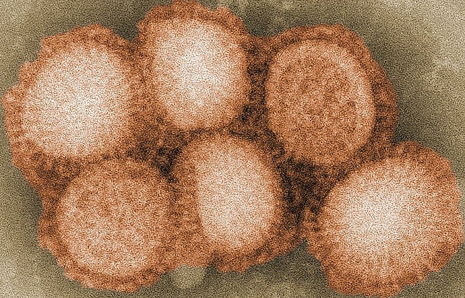 Świńska grypa w Suchej Beskidzkiej i Bielsku