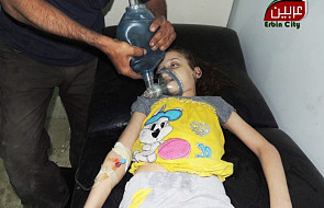 Syria: wstrząsające świadectwo lekarza