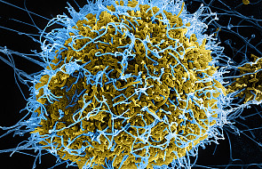 Niemcy: pierwszy pacjent wyleczony z eboli