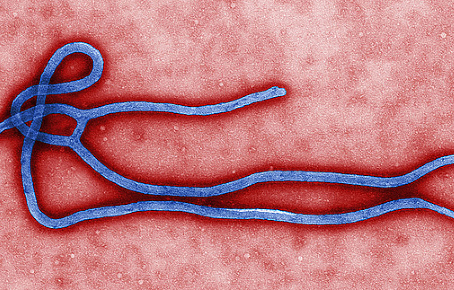 Stopień zagrożenia Ebolą w Polsce b. niewielki