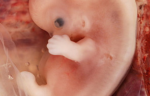 "Embrion to najwcz. stadium rozwoju człowieka"