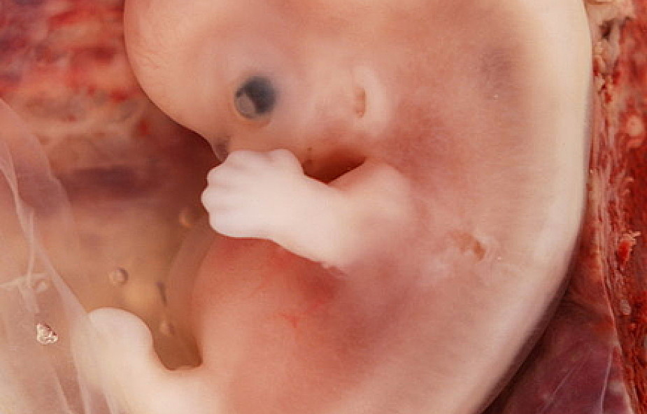 "Embrion to najwcześniejsze stadium rozwoju człowieka"
