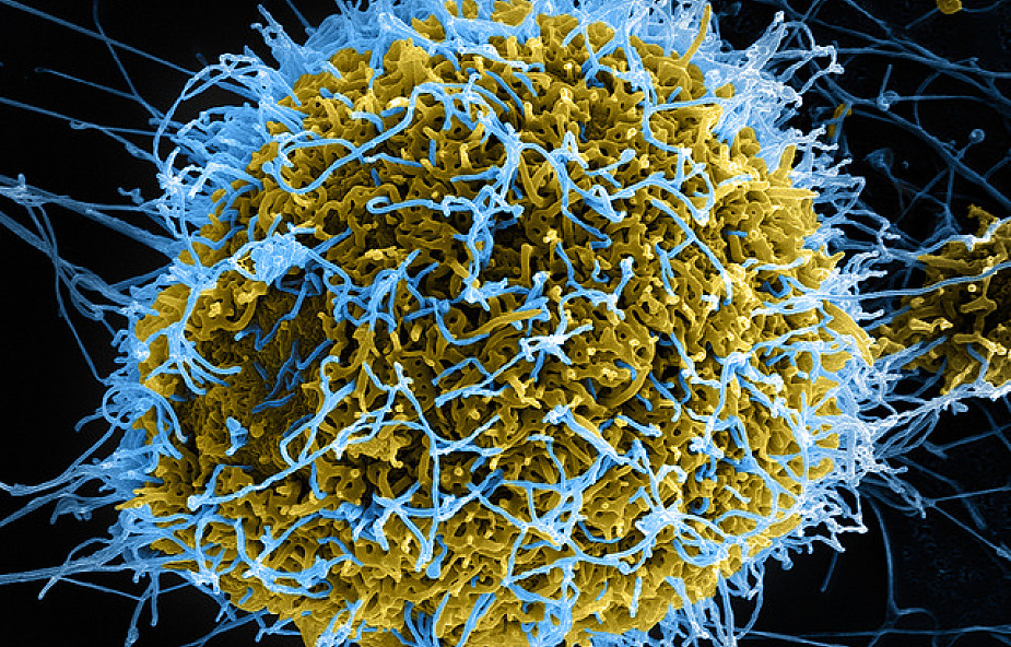 Spada liczba zarażeń wirusem eboli