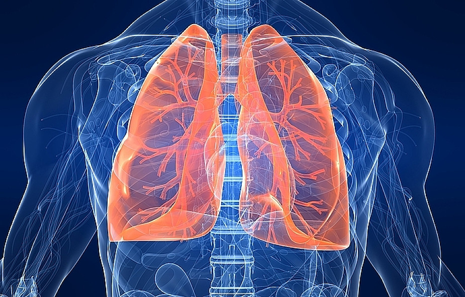 Nadciśnienie płucne coraz lepiej leczone w Polsce