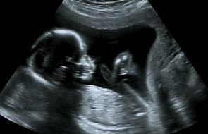 4 myśli o aborcji i ochronie życia