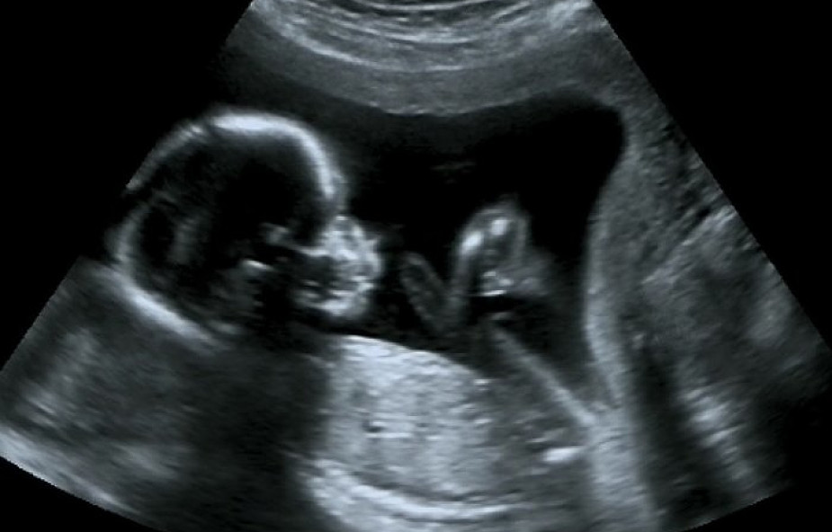 4 myśli o aborcji i ochronie życia