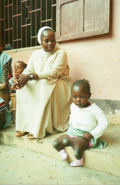 Kielczanie leczą dziewczynkę z Kamerunu - zdjęcie w treści artykułu