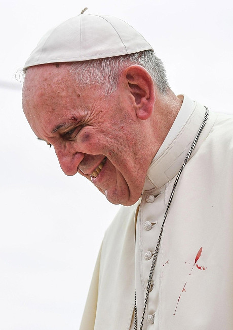 Dlaczego papież Franciszek ma podbite oko? - zdjęcie w treści artykułu