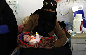 Jemen: wybuch kolejnej epidemii. W wyniku wojny błonica zbiera krwawe żniwo