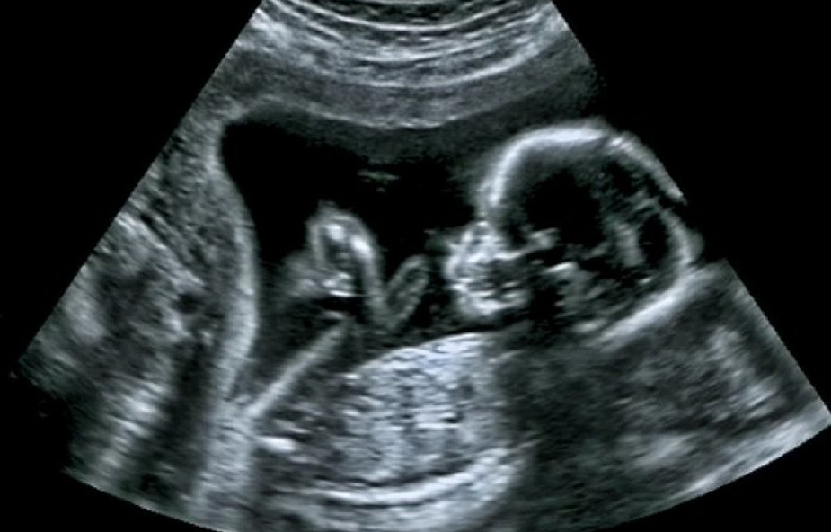 Irlandia: rząd zapowiedział referendum ws. liberalizacji aborcji