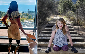 24-latka po amputacji nóg zdobyła szczyt, pokonując prawie 3 tys. schodów