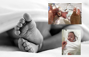 Zaraz po narodzinach mieścił się w dłoni. To najmniejsze dziecko na świecie