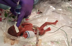 W szpitalu w San Diego przyszło na świat najmniejsze dziecko w dziejach