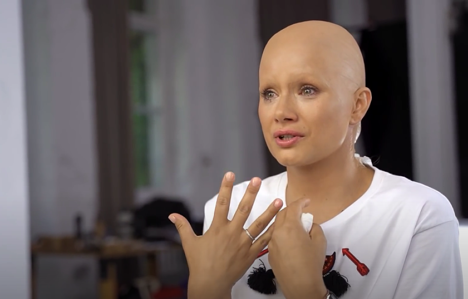 Znane aktorki poczuły, jak to jest utracić włosy po chemioterapii - rozpoznasz je? Poruszająca akcja Fundacji Rak'n'Roll