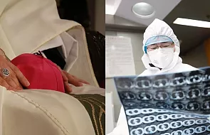 Biskup chory na koronawirusa został uleczony