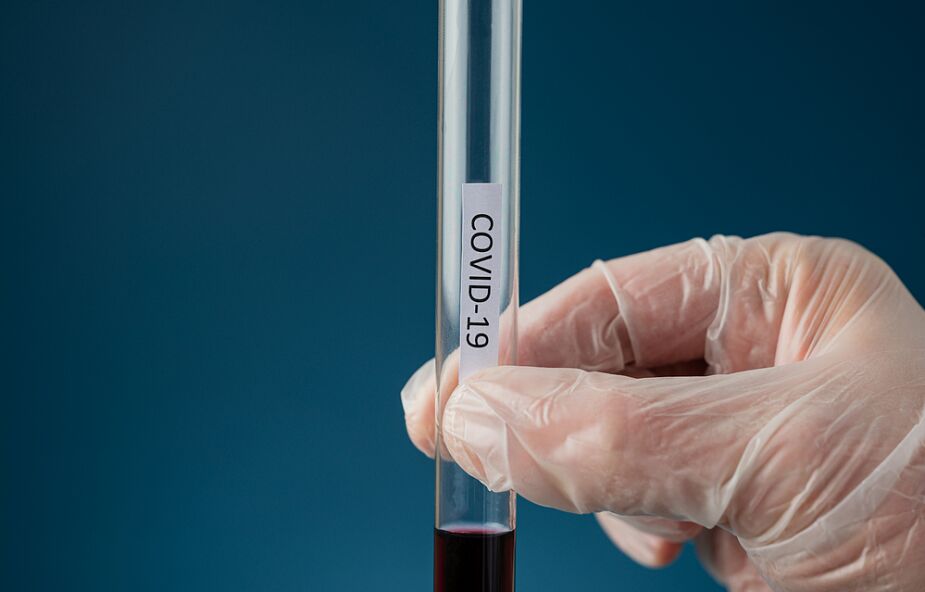 MZ: ostatniej doby wykonano ponad 21,1 tys. testów na koronawirusa