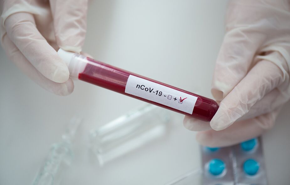 MZ: najwięcej testów na koronawirusa wykonano w woj. mazowieckim, najmniej - w opolskim