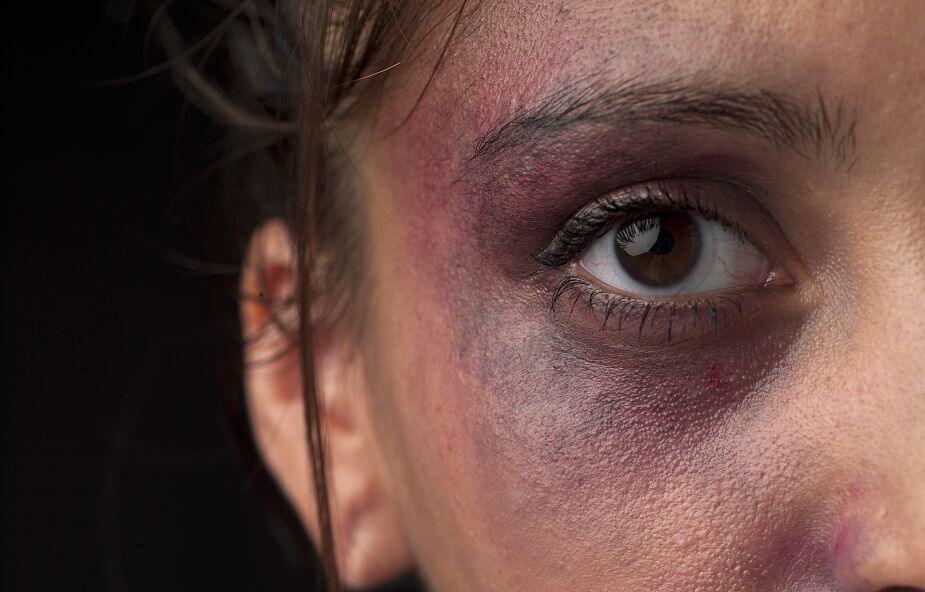 "Pewnie zasłużyła" i inne mity o przemocy domowej