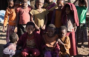 Szpital Dzieciątka Jezus będzie leczył chore dzieci z Etiopii