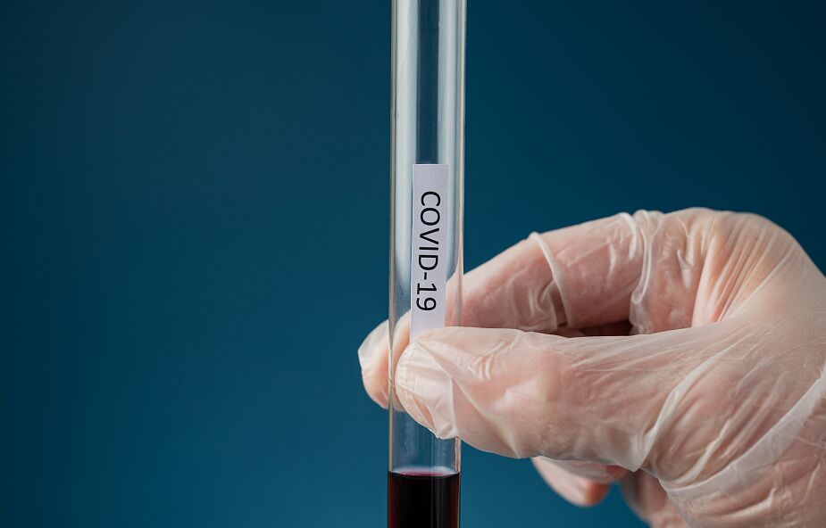 28 tys. nowych zakażeń COVID-19. Dla kogo bezpłatne testy i obowiązkowe szczepienia?