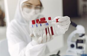 W Czechach potwierdzono pierwszy przypadek południowoafrykańskiego wariantu koronawirusa