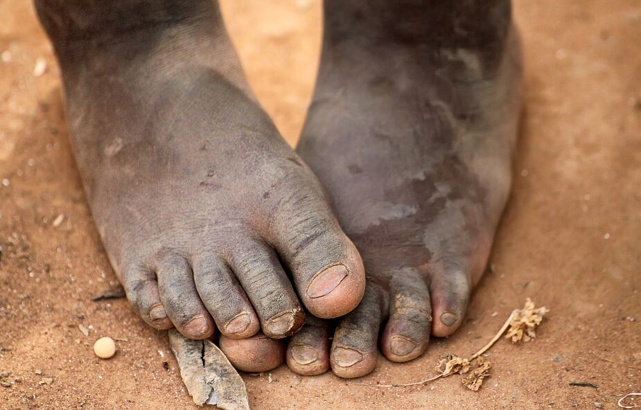 "Ludzie jedzą owady i nasiona zmieszane z błotem". Bardzo trudna sytuacja na Madagaskarze