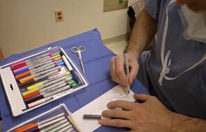 Troskliwy chirurg zmienia opatrunki w rysunki dla swoich małych pacjentów [WIDEO]