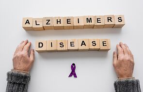 Naukowiec: Choroba Alzheimera rozpoczyna się o wiele wcześniej niż jesteśmy w stanie ją wykryć