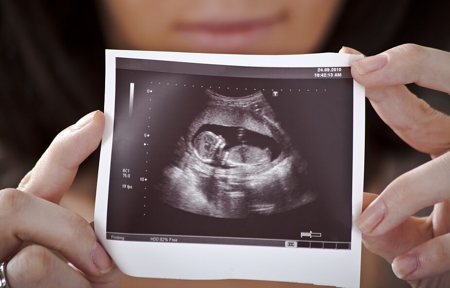Prawo do aborcji znajdzie się w stanowej konstytucji. Tak zdecydowali wyborcy w stanie Ohio